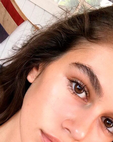 como se llama cuando no tienes cejas