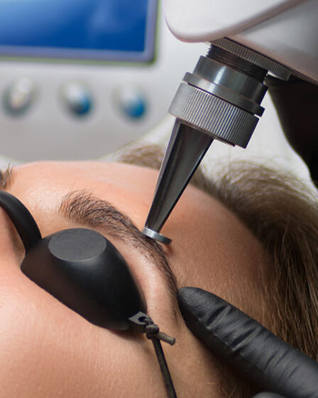 como se puede quitar el microblading