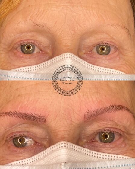 es cara la micropigmentacion