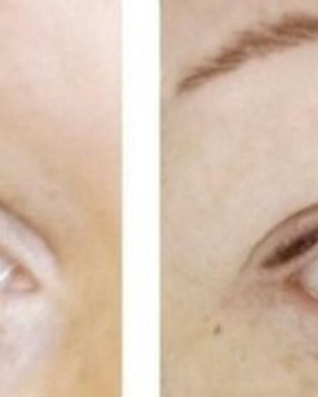 que consecuencias puede tener la micropigmentacion de cejas