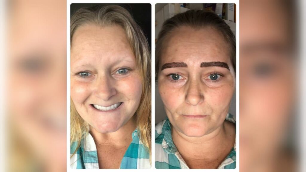 ¿Qué consecuencias tiene el microblading?