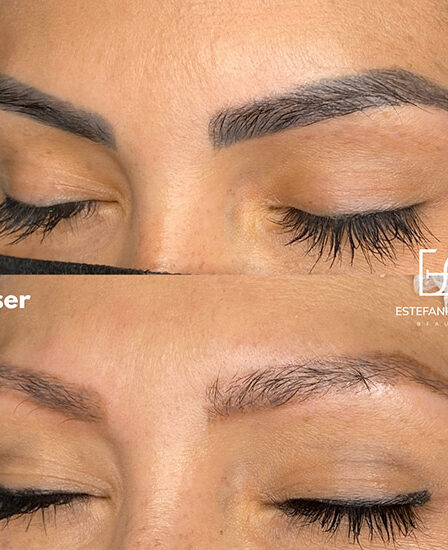 que pasa si me expongo al sol despues de microblading