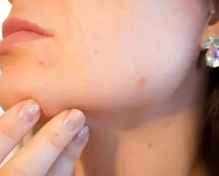 que pasa si me pongo vaporub en la ceja