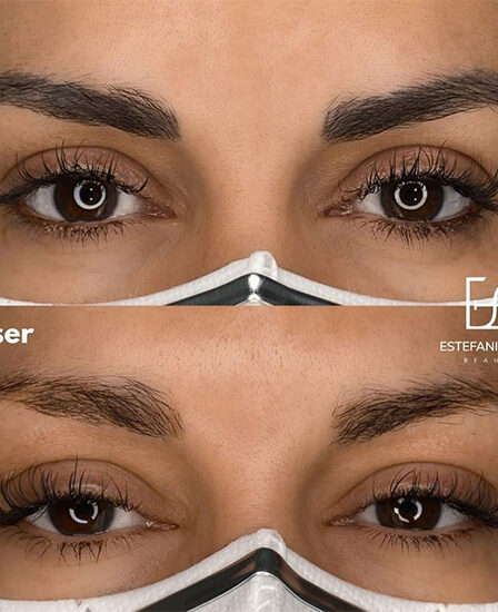 como queda la ceja despues de la micropigmentacion