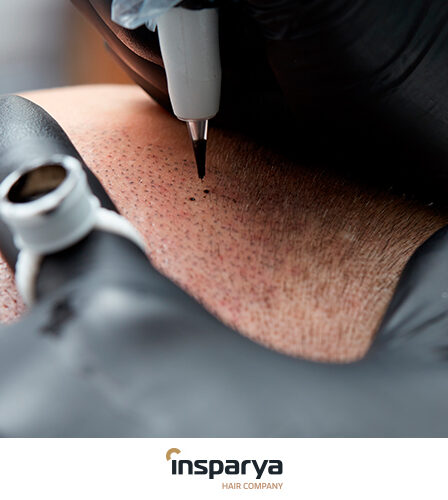 cuantas sesiones de micropigmentacion se necesita