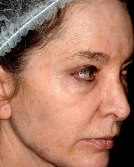 que demuestra la falta de cejas en una persona